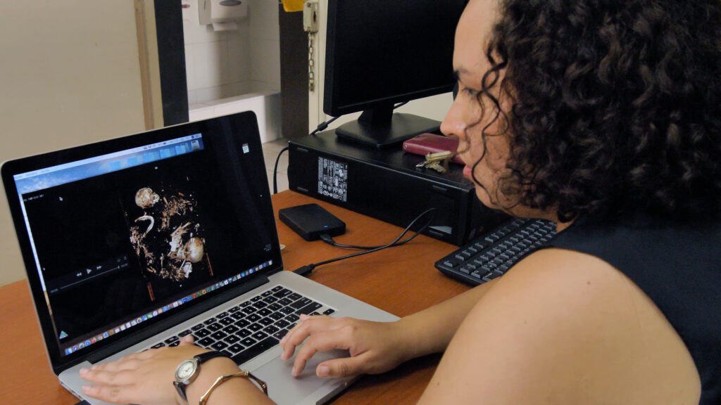 Lucía Watson viendo en una laptop imágenes de tomografía y rayos X