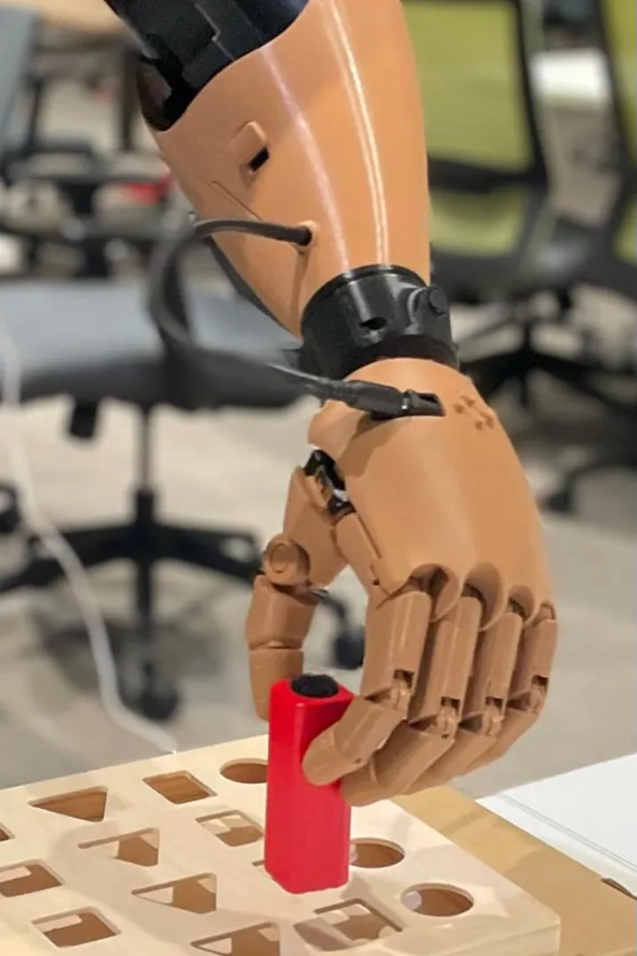 Prótesis LAT Bionics.