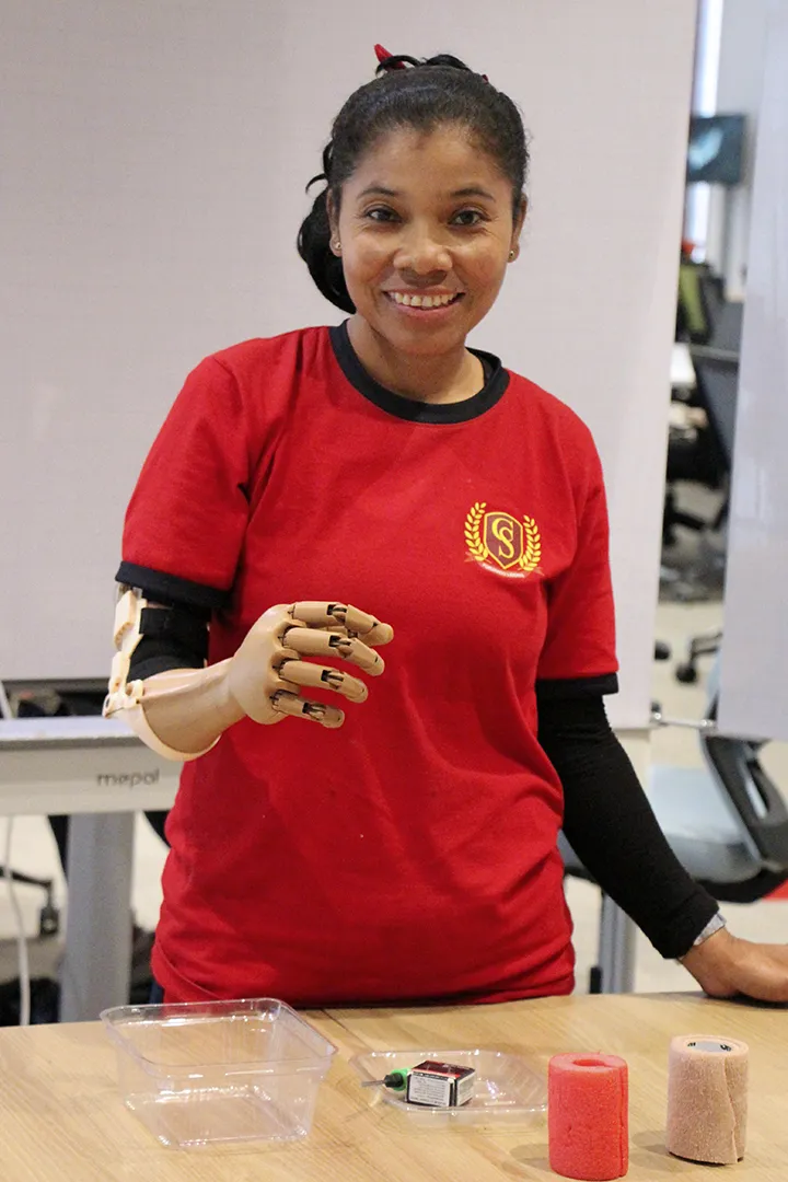 Prótesis LAT Bionics.